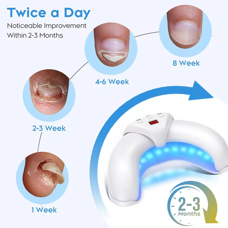 KTS półłukowe urządzenie laserowe do grzybicy paznokci 12x470nm 6x910nm leczenie grzybicy paznokci paznokci u stóp terapia grzybicza paznokci wyświetlacz czasu 2000mA