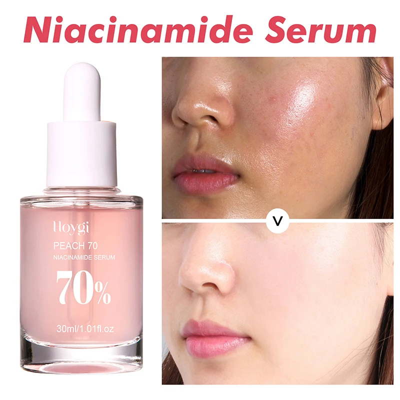 Pêssego 70% niacinamida soro 30ml hidratante evitar secura óleo essencial facial aumentando a elasticidade suave suavizar cuidados com a pele