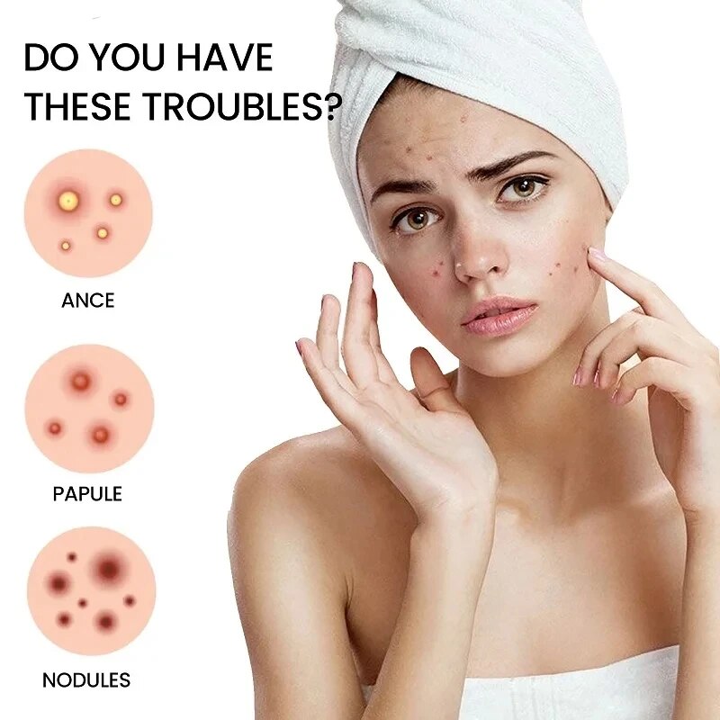 Reparatie Acne Patch Gezichtsverzorging Vervagen Vlekken Puistje Marks Gesloten Acne Vlekken Cover Acne Puistje Reparatie Patch