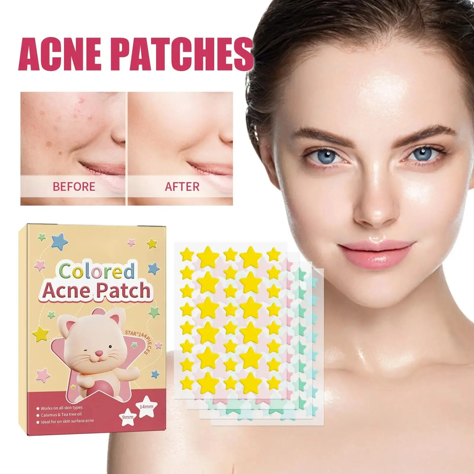 Star Acne Patch Fade Away, Pimple Marks, Poro limpo, Pele lisa, portátil, pentagrama colorido, 144pcs