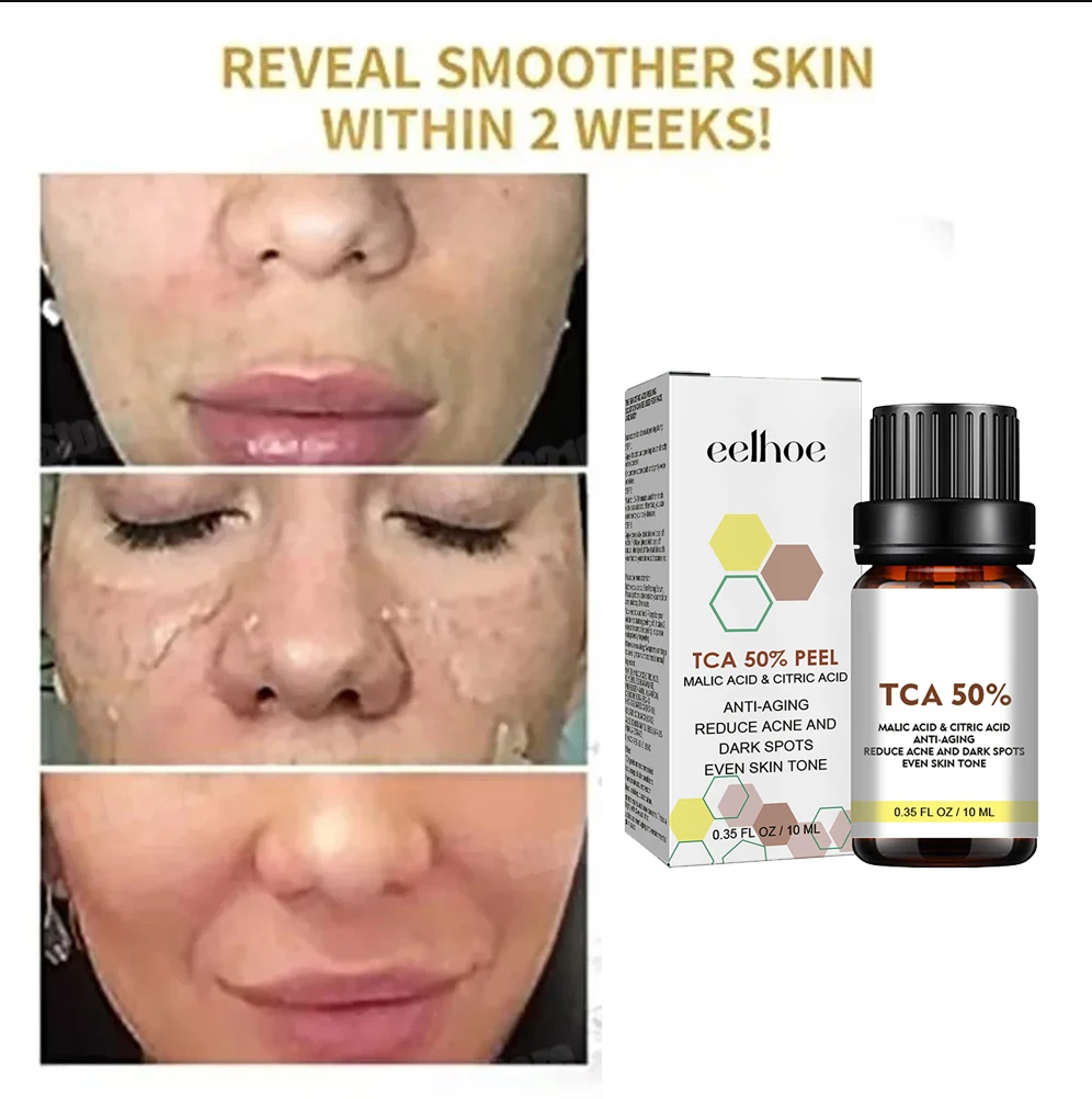 Salicylic Acid Face Facial Peel Neutraliser Face Deep At Home Chemical Peel Exfoliate Refine skin care serum NEW