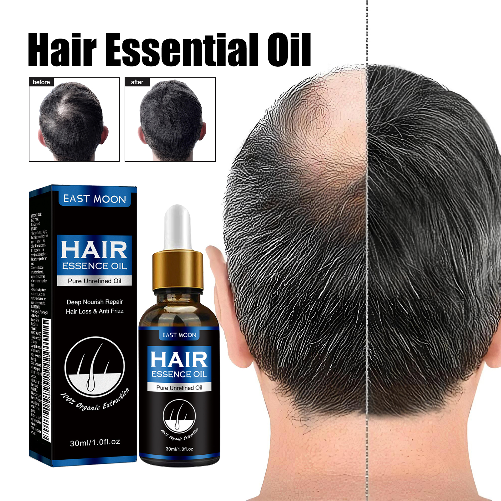 Óleo essencial de crescimento capilar de alecrim, nutrição profunda do couro cabeludo, anti perda de cabelo, reparação de danos, óleo de recrescimento, tratamento de desbaste