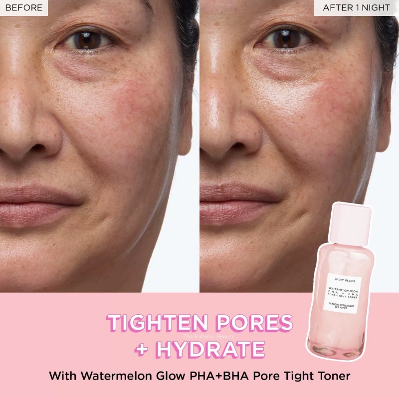 150ml WATERMELON PHA + BHA tóner facial cuidado de la piel coreano minimizador de poros con ácido hialurónico exfoliante suave para apretar