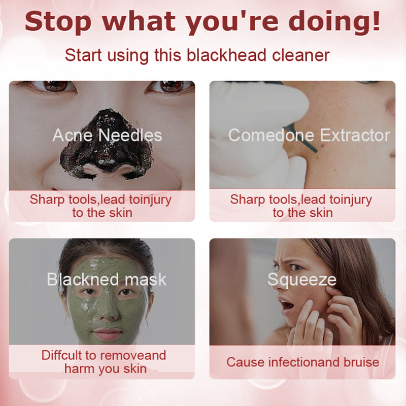 Removedor de cravo diamante dermoabrasão nariz vácuo poros limpador acne espinha sucção extrator usb recarregável ferramenta cuidados com a pele