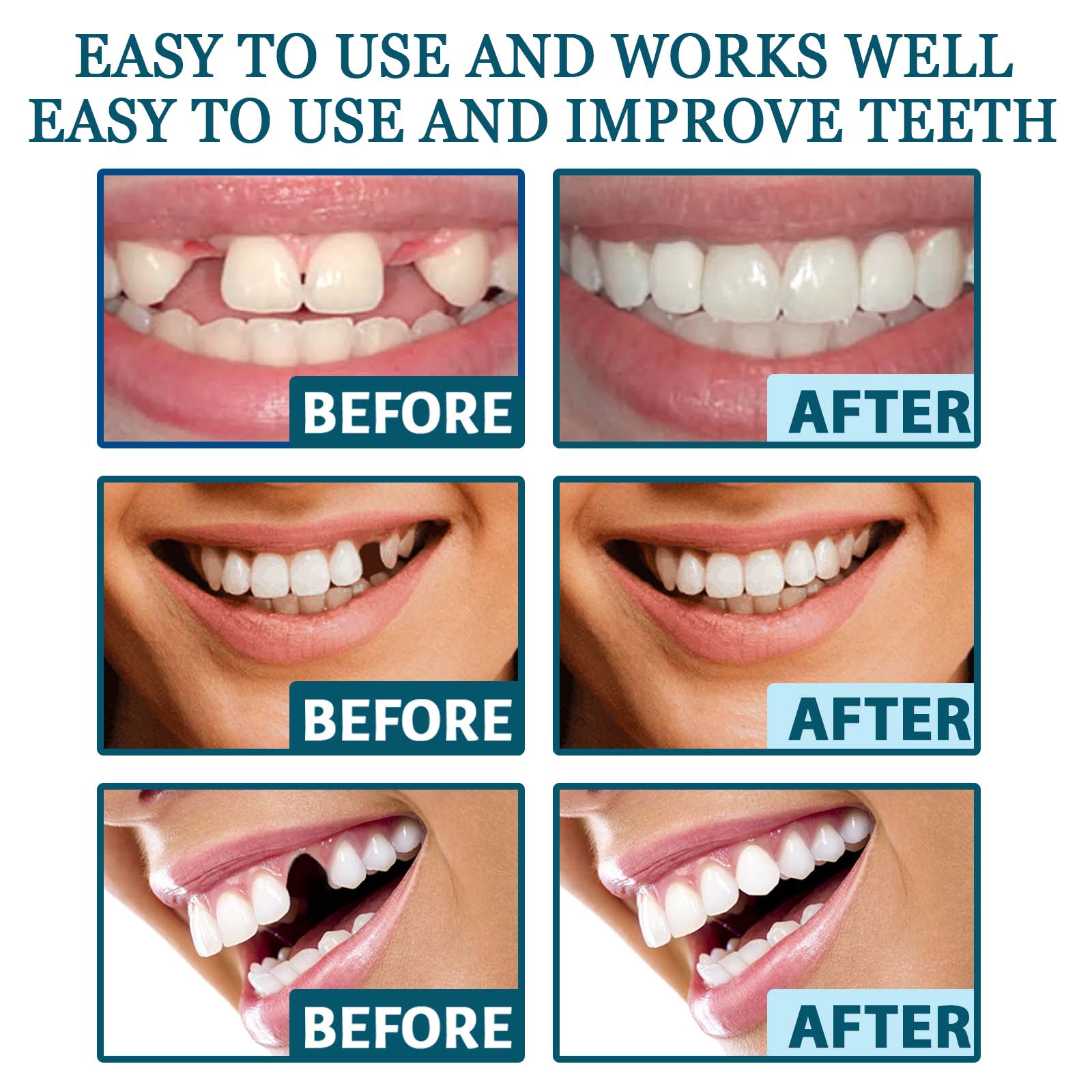 Adjustable Buckle Dentures Decorate Teeth Fill Gaps Correct Teeth Easy To Use. Suitable For Both Men And Women. Sentures Kit