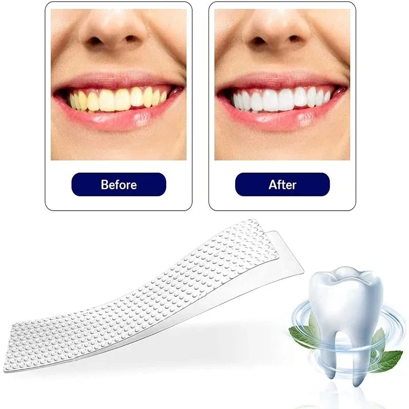 5D Dental Paste Teeth Bright White Tooth Paste Green Tooth Paste Neutral Tooth Paste 7 Bags And 14 Pieces