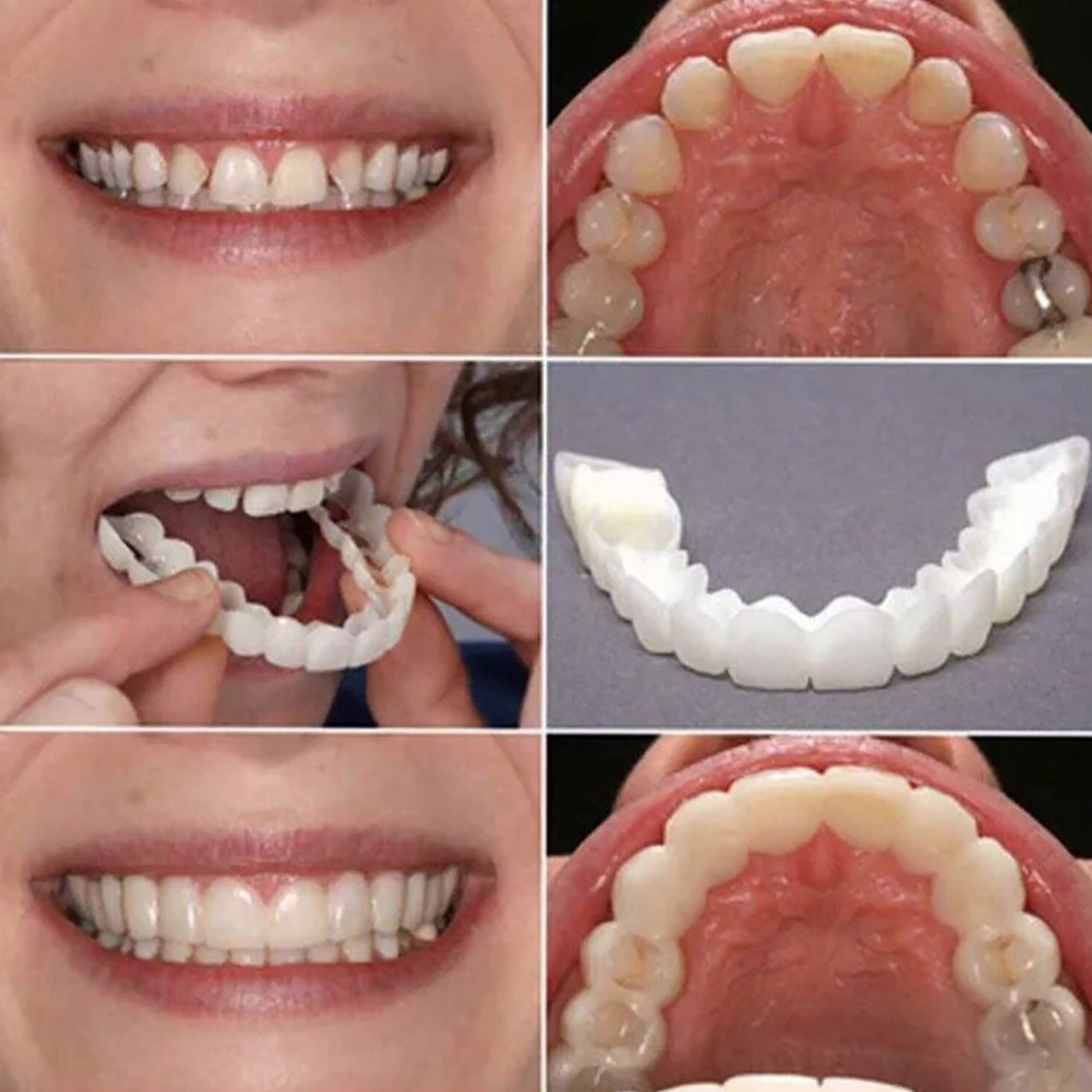 Tandenfineer Whitening Kunstgebit Bretels Tijdelijke valse tanden Cover Perfecte glimlach Comfortabele pasvorm Protheset