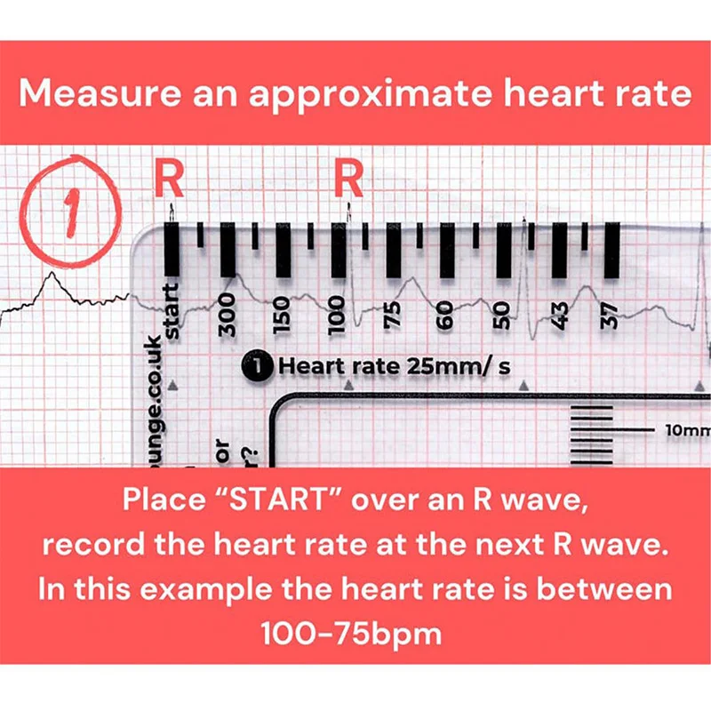 Ecg 7 Step Ruler 7 Step Scale For Ecg Observation Portable Transparent 7step Ruler Measurement Tool Ruler For Ecg Interpretation