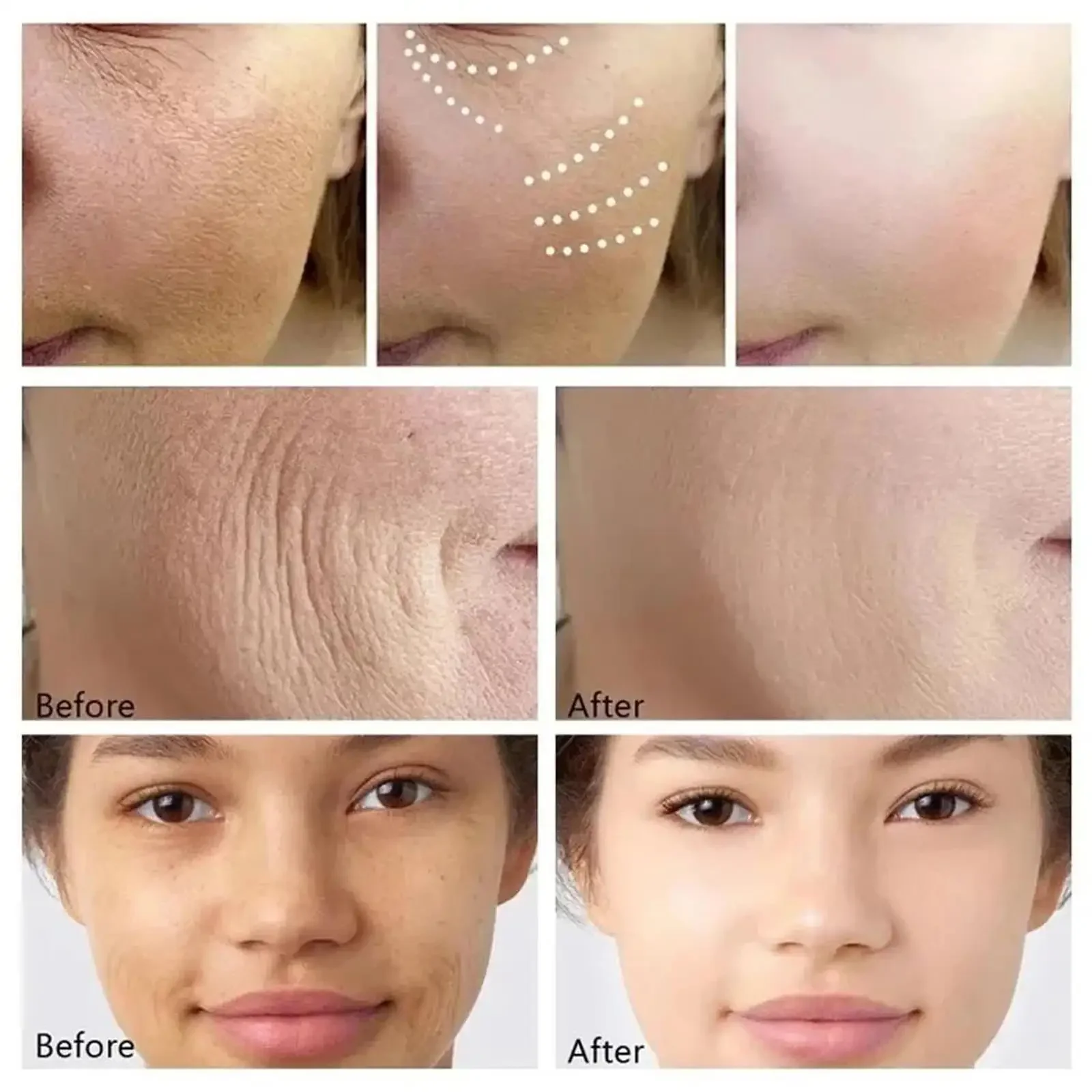 Retinol removedor de rugas rosto conjunto instantâneo endurecimento levantamento anti-envelhecimento soro desvanece-se linhas finas clareamento coreano produtos de cuidados com a pele
