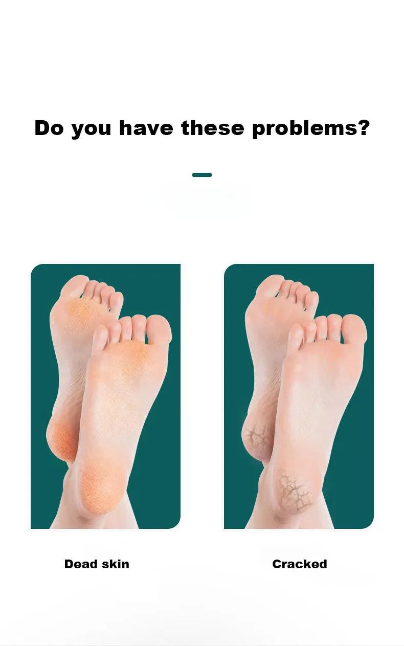 Dupla face arquivo de pé pedicure ferramentas cuidados com os pés removedor de calos de pele morta aço inoxidável profissional