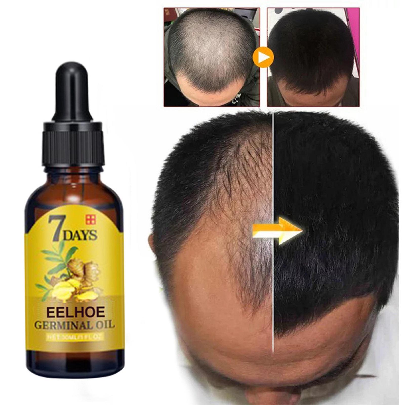 Gengibre cuidados com o cabelo líquido evitar perda de cabelo nutrir folículos capilares fortalecer as raízes do cabelo aumentar brilho do cabelo nutrição essência