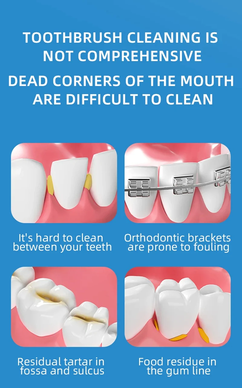 nterdental Brush Soft Rubber Teeth Cleaning Tools Dental Cleaning Between Teeth Toothbrush Oral Hygiene Care Tools