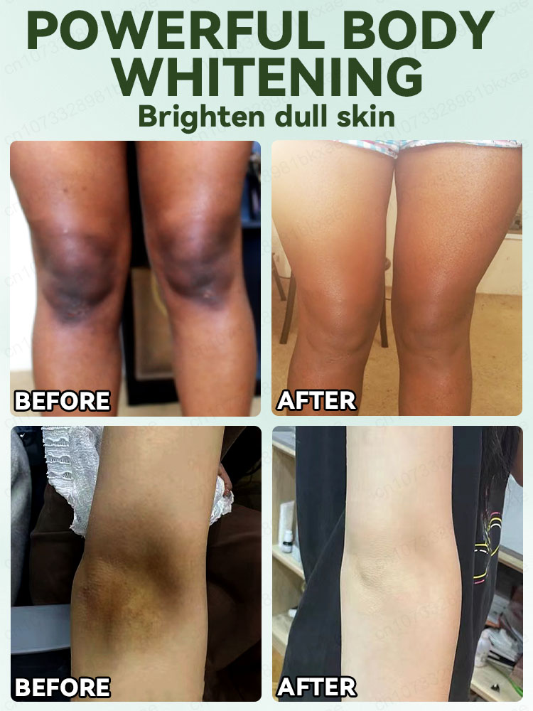 Скажи прощай в меланин