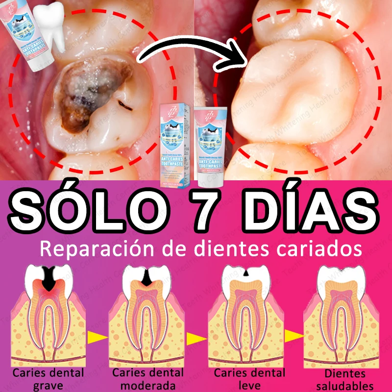 Eʟ 99% ᴅᴇ ᴘᴇʀsᴏɴᴀs ʀᴇᴄᴏᴍᴘʀᴀ, ɢʀᴀɴ ᴏғᴇʀᴛᴀ, ʀᴇᴘᴀʀᴀᴄɪᴏ́ɴ ᴅᴇ ᴄᴀʀɪᴇs ᴅᴇɴᴛᴀʟᴇs