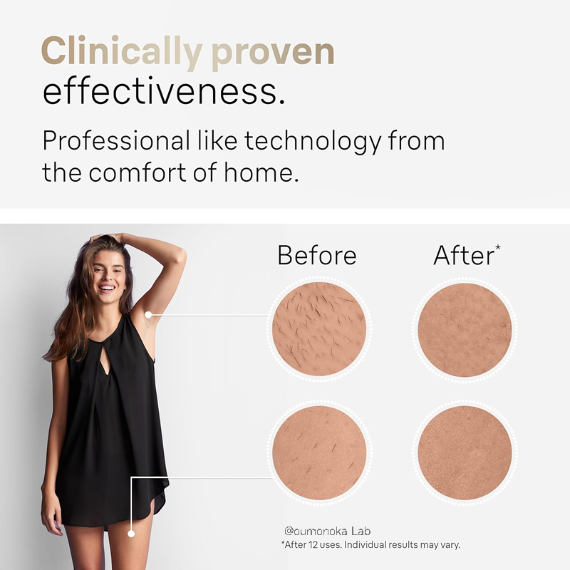 IPL ontharingsapparaat 999999   Knippert Permanente Epilator Lichaamsbehandeling Thuisgebruik voor Dames Heren Gezichtsscheerapparaat Snijmachine