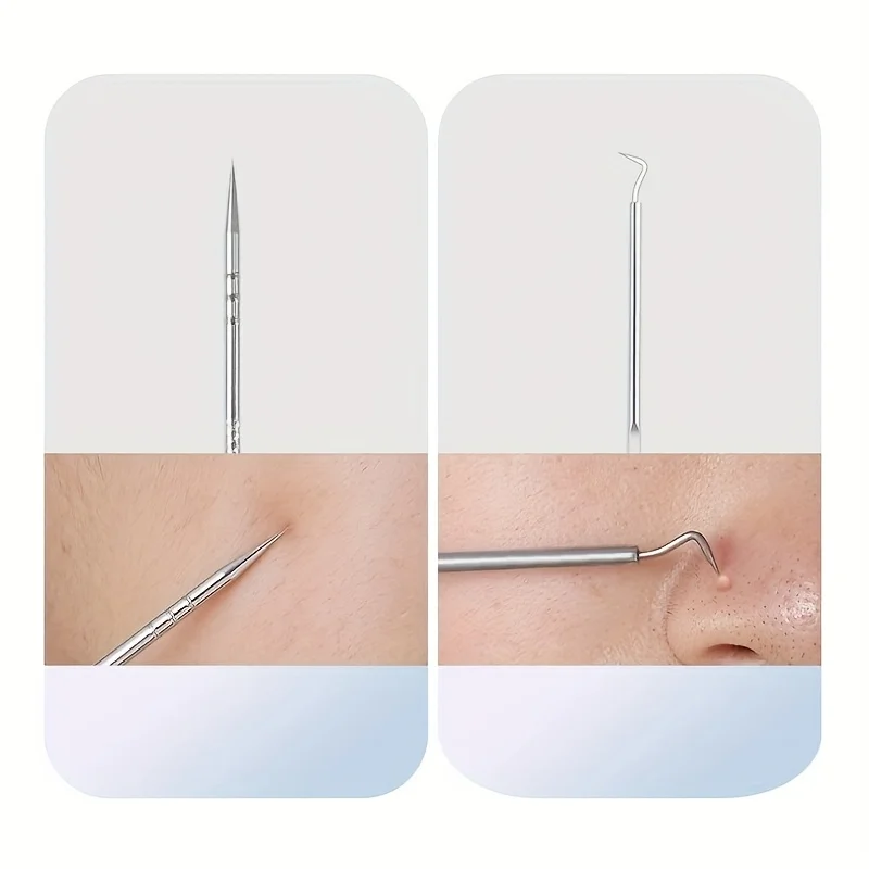 ชุดเครื่องมือกําจัดสิวสแตนเลส 4/7/8 ชิ้น - ชุด Blackhead & Pimple Popper สําหรับทุกสภาพผิว, ปราศจากน้ําหอม, เครื่องมือเสริมความงาม