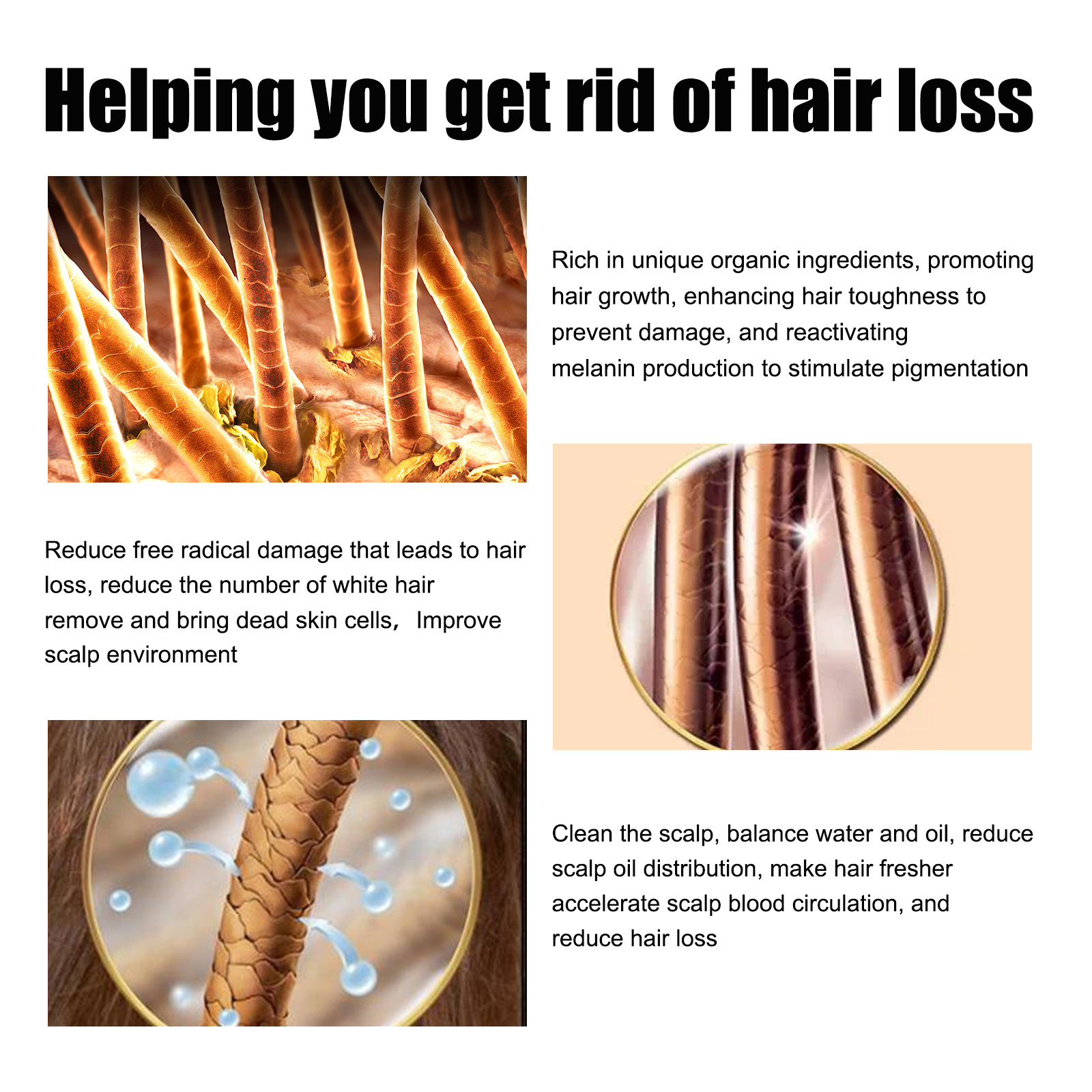 Óleo essencial de crescimento capilar de alecrim, nutrição profunda do couro cabeludo, anti perda de cabelo, reparação de danos, óleo de recrescimento, tratamento de desbaste