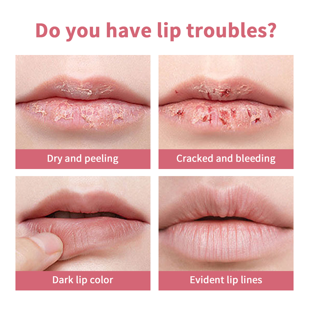 Rosa mel quase batom matizado bálsamo labial em mel preto poderoso repulper labial remover lábios escuros bálsamo labial esfoliante para lábios
