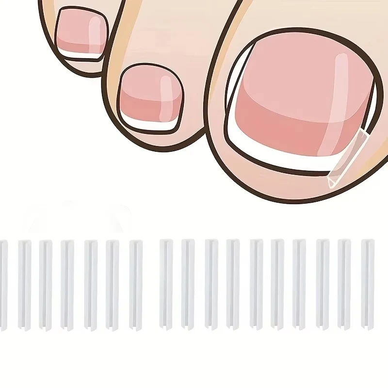 Herramienta de corrección de uñas encarnadas, tratamiento de uñas encarnadas, parche elástico, pegatina, Clip alisador, herramienta de pedicura