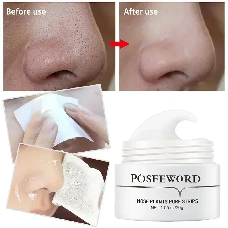 Dissolvant de points noirs efficace, masque nasal, bande de pores, masque noir, Peeling, traitement de l'acné, nettoyage en profondeur, soins pour la peau, corée