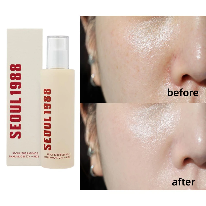 Seúl 1988 Juego de cuidado de la piel coreano Caracol Mucín Cuidado del contorno de ojos Vitamina C Retinol Eliminación de ojeras Seúl 1988 Cosméticos Coreanos