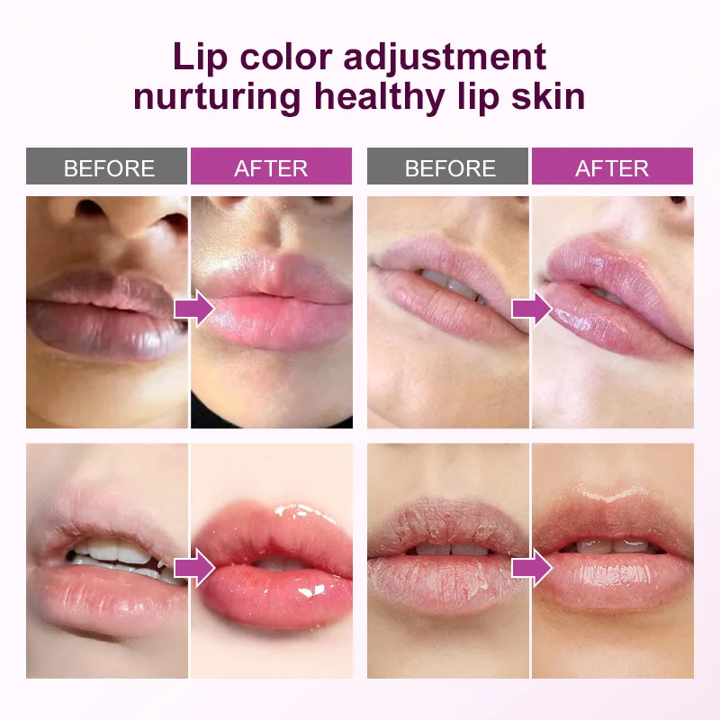 Mascarilla de labios oscura, aclaramiento rápido, exfoliante de labios rosa, línea de labios que se desvanece, crema hidratante para la piel muerta, productos de cuidado coreano, belleza y salud
