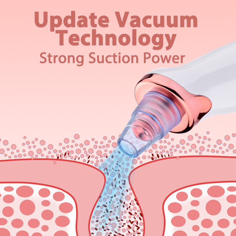 Removedor de cravo diamante dermoabrasão nariz vácuo poros limpador acne espinha sucção extrator usb recarregável ferramenta cuidados com a pele