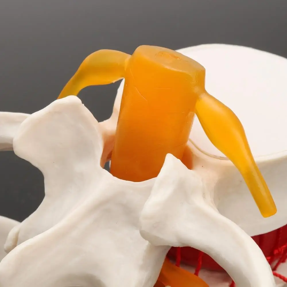 Anatomia człowieka Szkielet Kręgosłup Przepuklina dysku lędźwiowego Model nauczania Mózg Czaszka Traumatyczny pistolet Przybory szkolne Instrument medyczny
