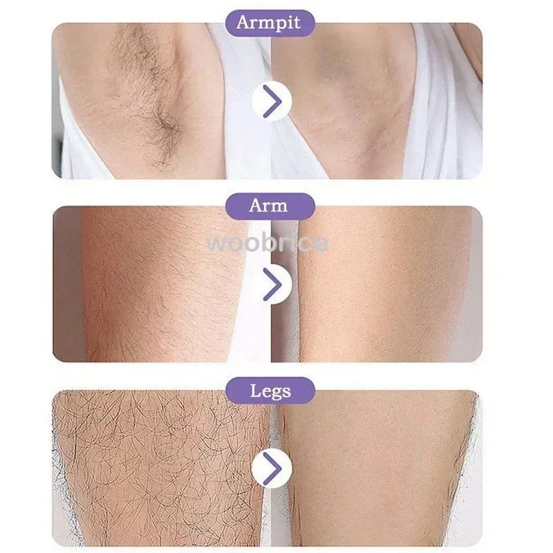 Gum Epilator Beenhaar Kristal Epilator Haar Fysieke ontharing Gum Glasverwijderaar Pijnloos Epilator Reiniging Herbruikbaar
