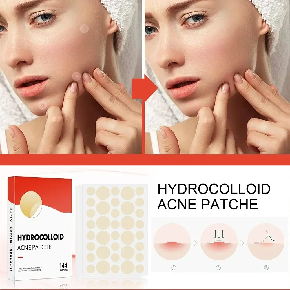 Hydrocolloid Acne Patch Facial Blemishes Pimple Marks Closed Acne Blemishes Cover Acne Pimple Repair Patch Invisible Acne Patch