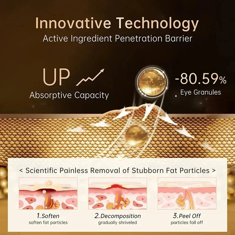 Crema para ojos eliminador de gránulos de grasa, crema firme antihinchazón, antiinflamatorio, Reduce las ojeras, desvanece las líneas finas, barrera reparadora Sk
