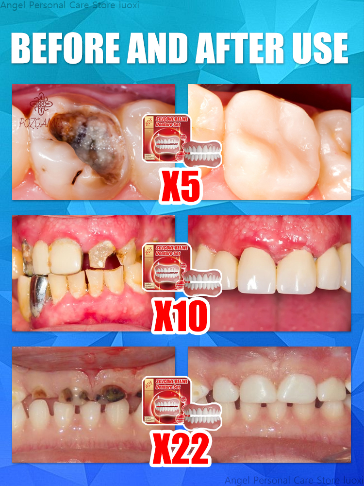 керамические протезы создают свою улыбку естественно!