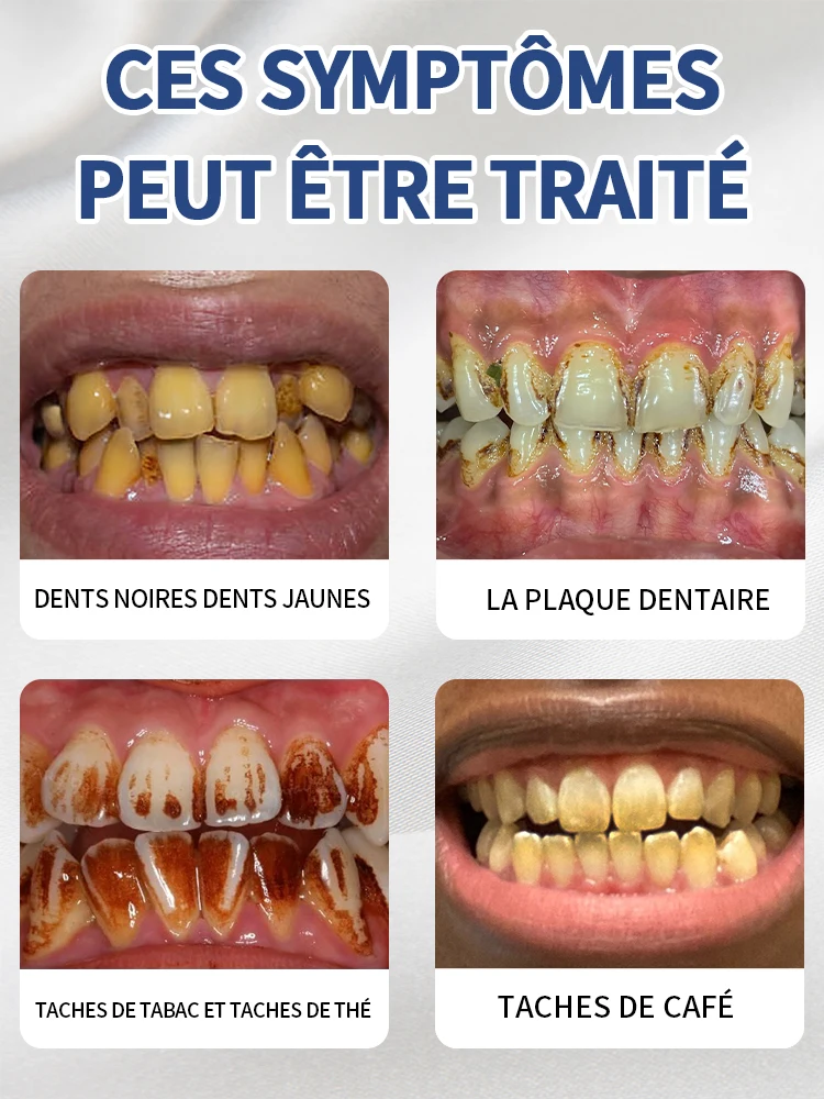 Résout tous les problèmes dentaires