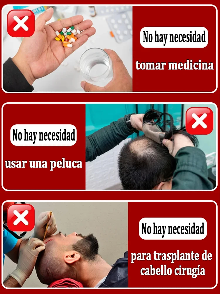 La pequeña botella azul de WPRBREGT nutre profundamente el cuero cabelludo, revitaliza los folículos pilosos y promueve el crecimiento rápido del cabello en 7 días.