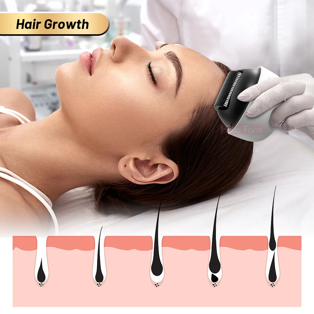 Hallo Gesicht Derma roller 1200 Pin Mikron adel Bio Roller G4 Haarwuchs Körper Dehnung streifen Entfernung Hautpflege mit separater Abdeckung