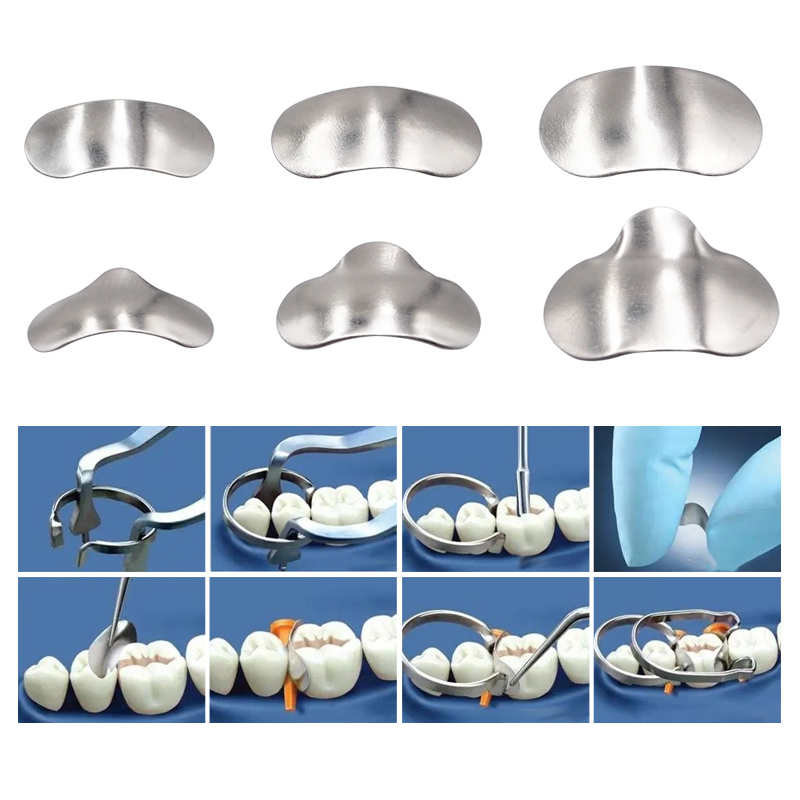 100 Cái/hộp Nha Khoa Ma Trận Mặt Cắt Viền Kim Loại Ma Trận Ban Nhạc Nhựa Kẹp/Seperating Vòng Nha Sĩ Dụng Cụ