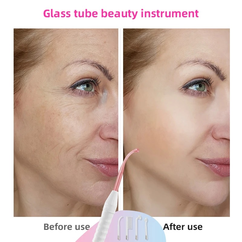 4 in1 elettrodo tubo di vetro macchina Spot Acne bacchetta viso Spa cura della pelle del viso elettroterapia