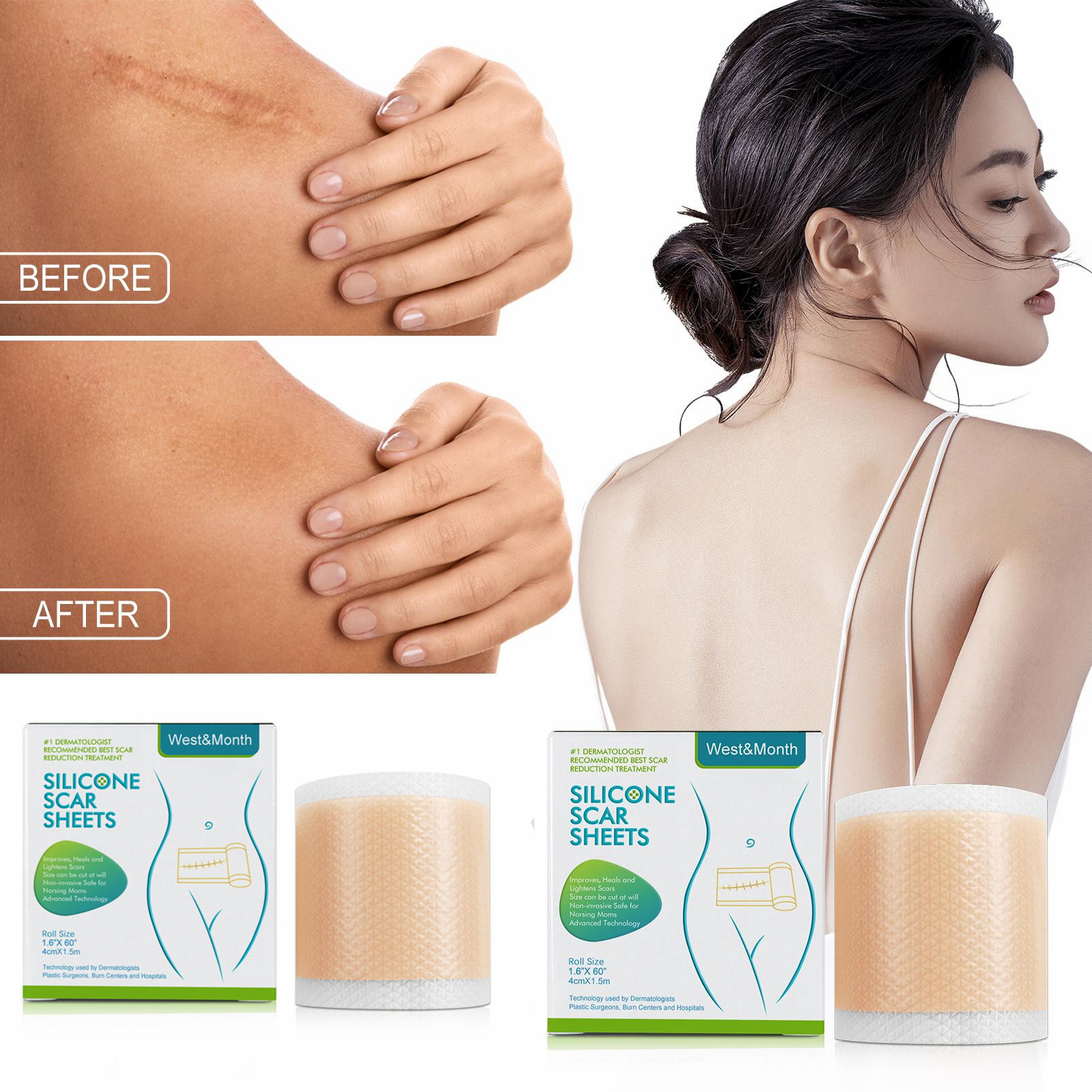 3 рулона, силиконовые шрамы для удаления рубцов