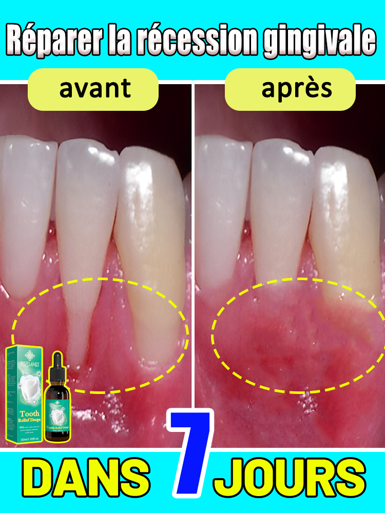 Réparer les gencives endommagées, soulager la douleur des gencives, renforcer les gencives et restaurer des gencives saines