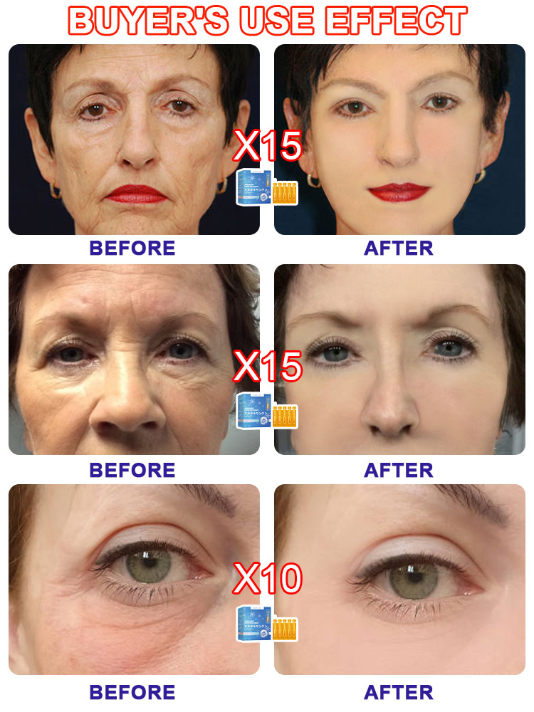 Морщины исчезают, лифтинг и затягивает, ремонт чувствительности