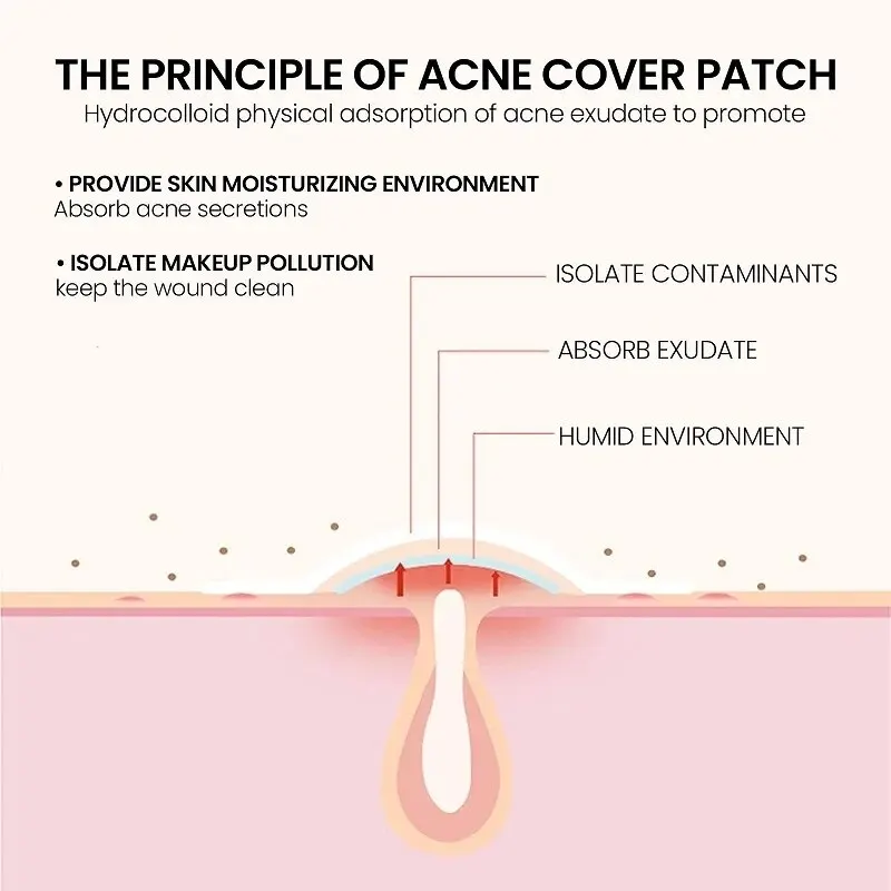 Parche de reparación de acné para el cuidado de la piel Facial, manchas, marcas de granos, manchas de acné cerradas, cubierta de granos de acné