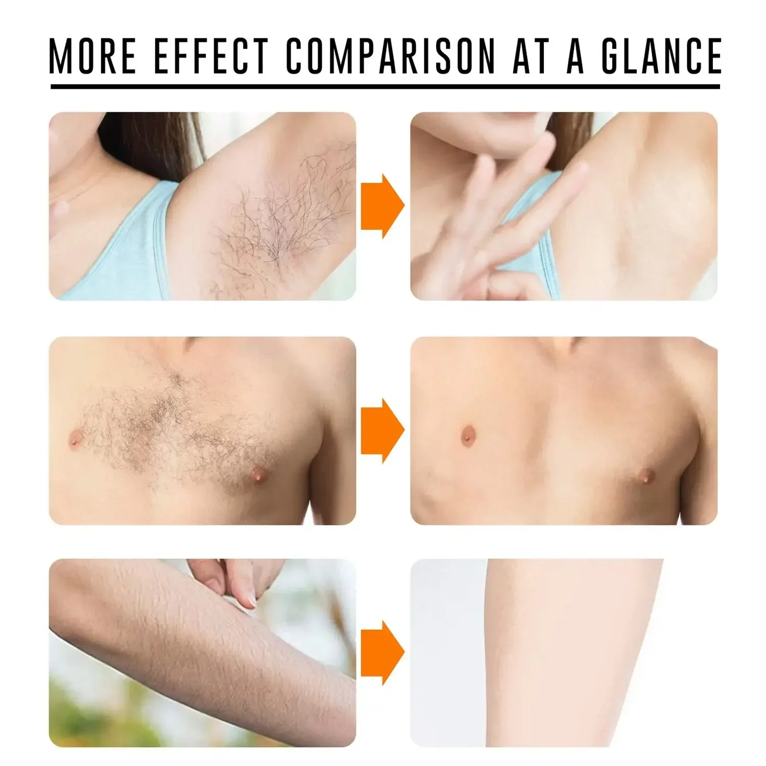 Крем для удаления волос Сакура, быстрый безболезненный ингибитор роста волос, рука, подмышки, ноги, интимные зоны, постоянная депиляция для мужчин и женщин