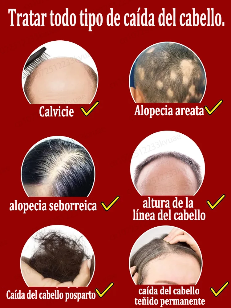 La pequeña botella azul de WPRBREGT nutre profundamente el cuero cabelludo, revitaliza los folículos pilosos y promueve el crecimiento rápido del cabello en 7 días.