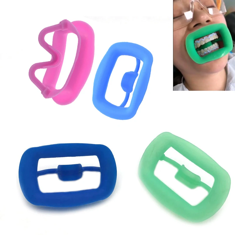 ทันตกรรมซิลิโคน 3D Lip Cheek Retractor เปิดปากแก้มขยายทันตกรรมจัดฟันวัสดุสิ้นเปลืองมีให้เลือก 4 สี