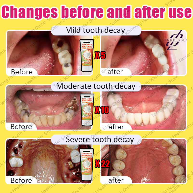 Горячая продажа черной техники для ремонта каркаса зубов。