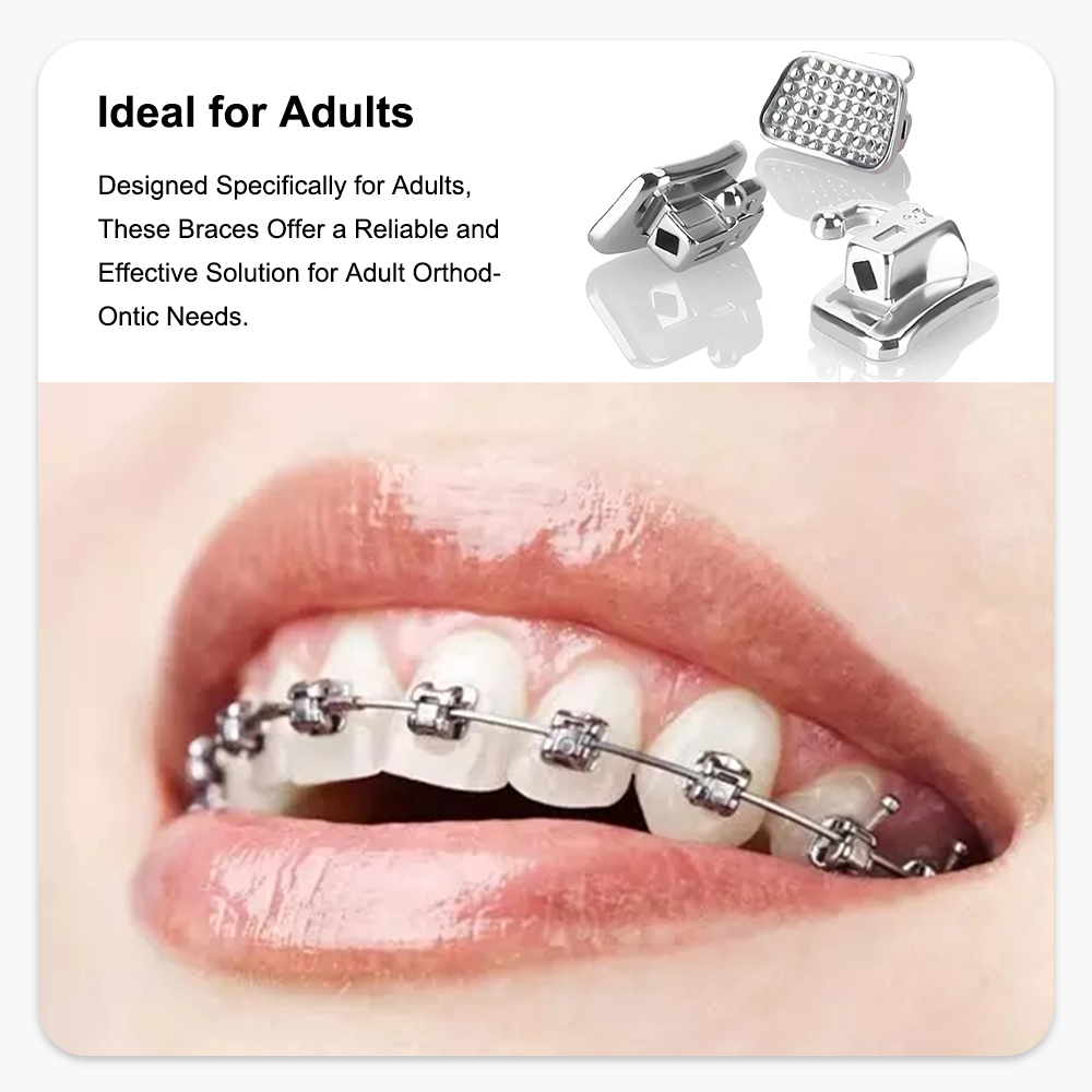 Denspay 80Pcs/20Sets Orthodontic  Buccal Tube Set Mesh Base Brakets Bondable Convertible Buccal Tubes Dental Orthodontic