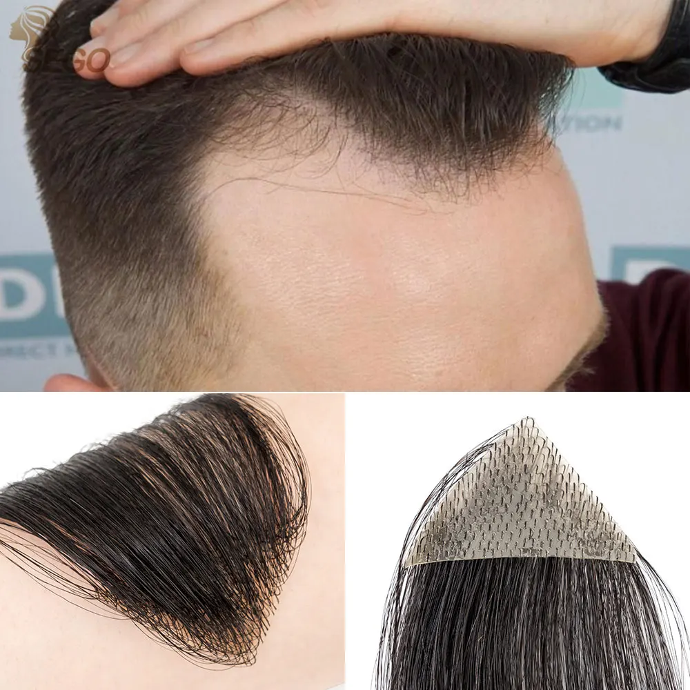 Sego remendo de substituição de cabelo humano queimaduras acidentais sem cabelo para homens mulheres perda de linha fina fita reta em substituição peruca