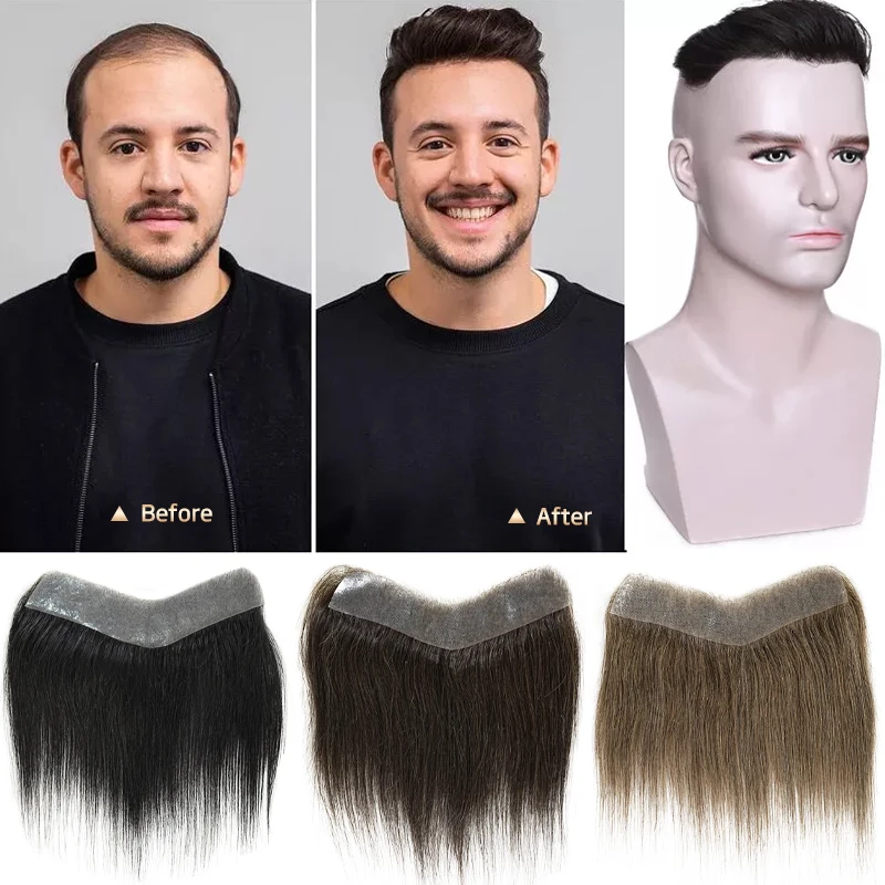 15cm 100% cheveux humains toupet droit Style V ligne de cheveux frontale pour hommes système de remplacement avant postiche en polyuréthane Extensions invisibles