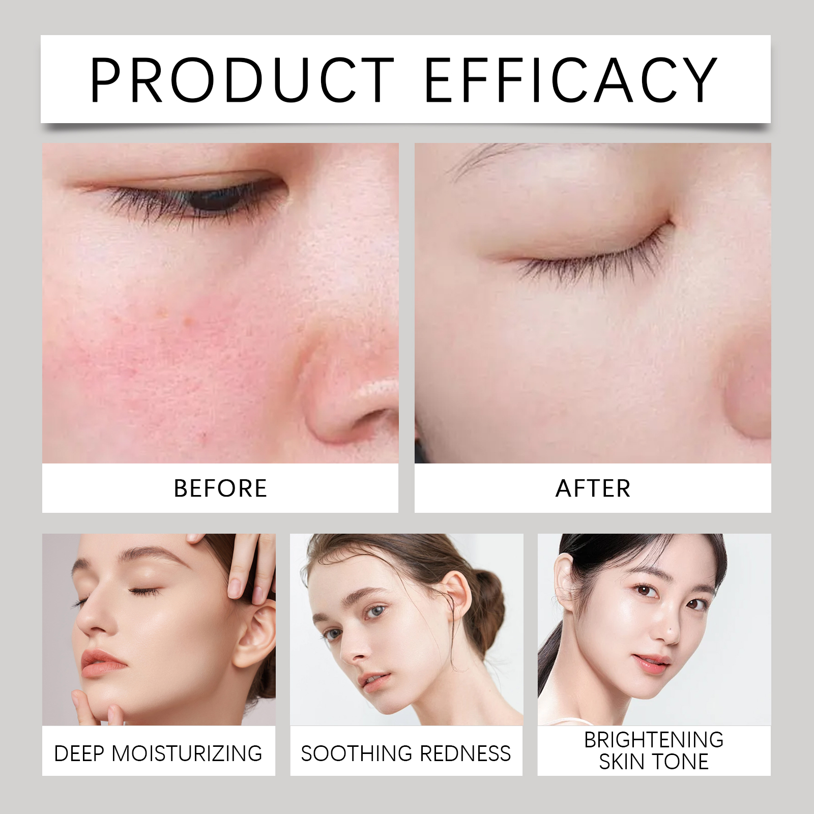 147 Relief Cream solution to skin problems Anti-sugar and antioxidant Address Blemishes Nourish Long lasting Moisturizer Korean