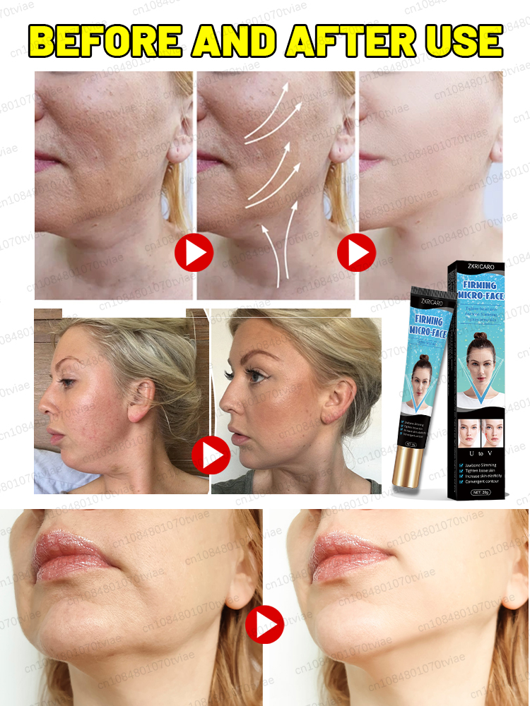 Нет двойного подбородка